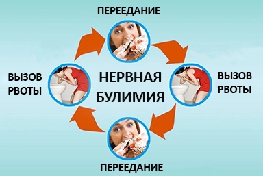 Лечение булимии в Иловле